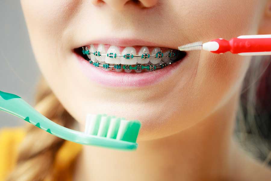 A woman holding up a toothbrush and interdental brush up to the braces on her teeth.